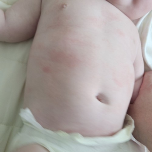 Image of product Dermexa Ato Nighttime Balm by Aveeno Baby